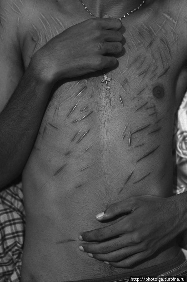 Часть этих шрамов Сунил получил во время пыток, часть — нанёс себе сам в состоянии аффекта Негомбо, Шри-Ланка