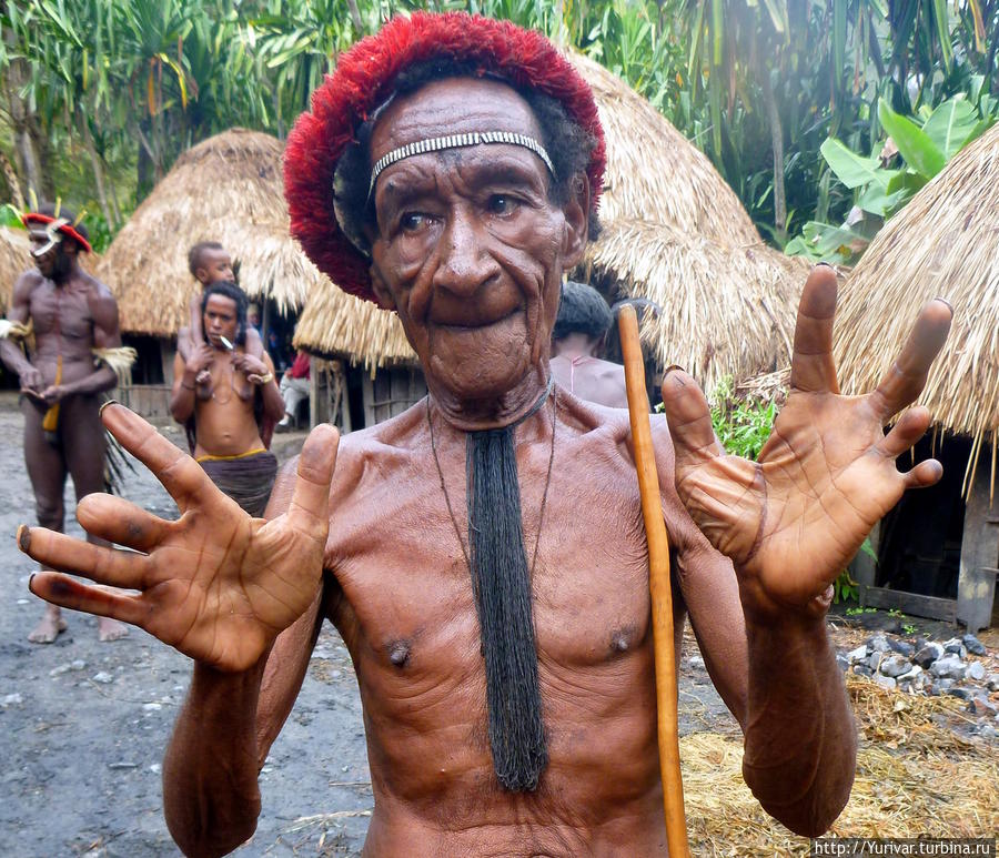 Еще сохраняется обычай скорби у Дани — отрезание фаланг пальцев рук Вамена, Индонезия