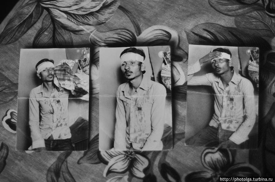 Фотографии, сделанные сразу же после избиения Сунила и его отца мусульманами Негомбо, Шри-Ланка Фотографии, сделанные сразу же после избиения Сунила и его отца мусульманами Негомбо, Шри-Ланка