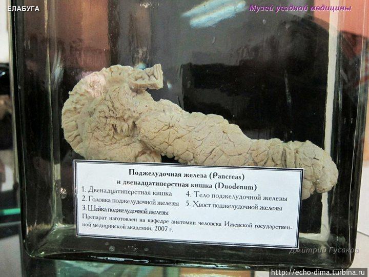 ЕЛАБУГА — ГОРОД МУЗЕЙ Елабуга, Россия