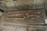 Этот скелет был найден в Никосии при раскопках. Голова, стопы и руки отсутствовали. Предположительно это был солдат 20-30 лет, который умер при обороне крепости от турок в 1570 г.